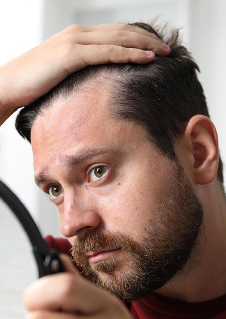 Hair Loss & Hair Transplant